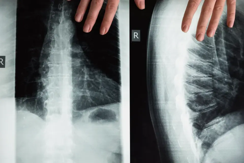 A veterinarian reviewing a dog's joint imaging on a lightbox